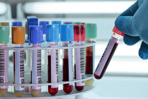 Tıbbi Tahlil ve Analiz Labaratuvarı